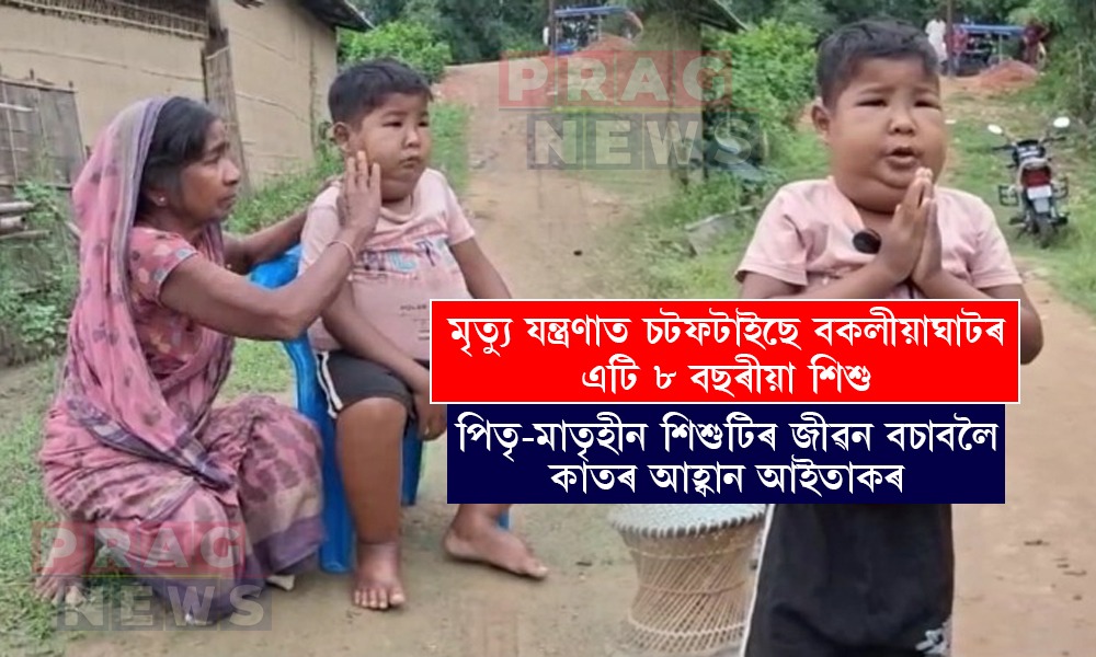 পখিলা খেদা বয়সত মৃত্যুৰ সৈতে যুঁজ পীযুষৰ; সহায় ভিক্ষা বিচাৰি ৰাইজক কাতৰ আহ্বান অসহায় আইতাকৰ