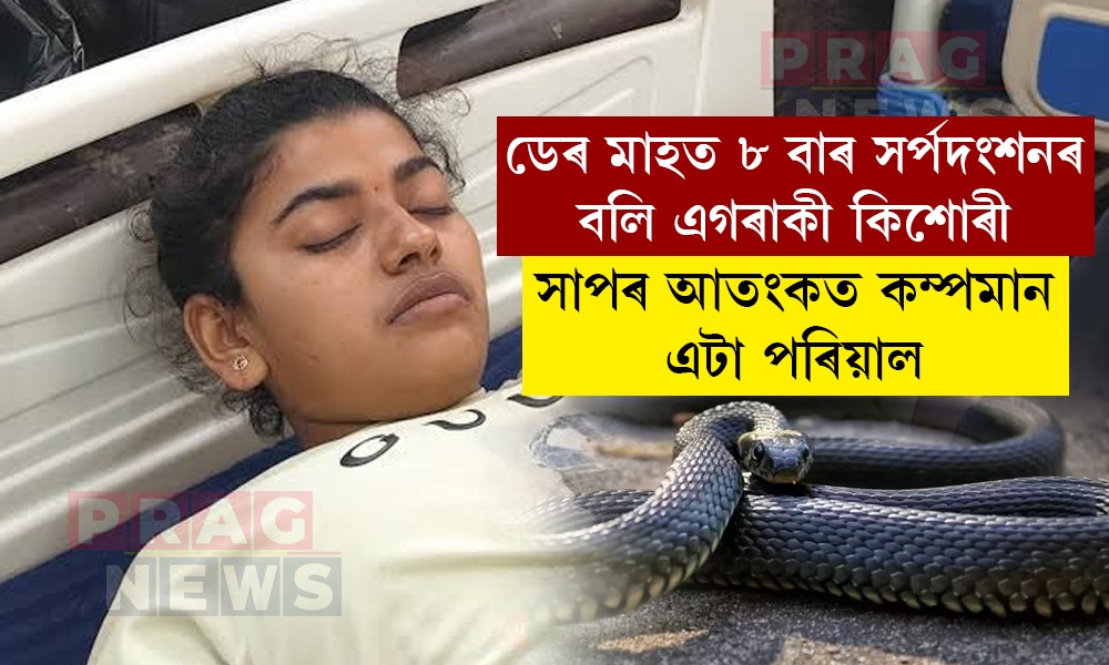 চাঞ্চল্যকৰ ঘটনা! এবাৰ, দুবাৰ নহয় ডেৰ মাহত ৮বাৰকৈ সাপে দংশন কৰিছে এগৰাকী কিশোৰীক