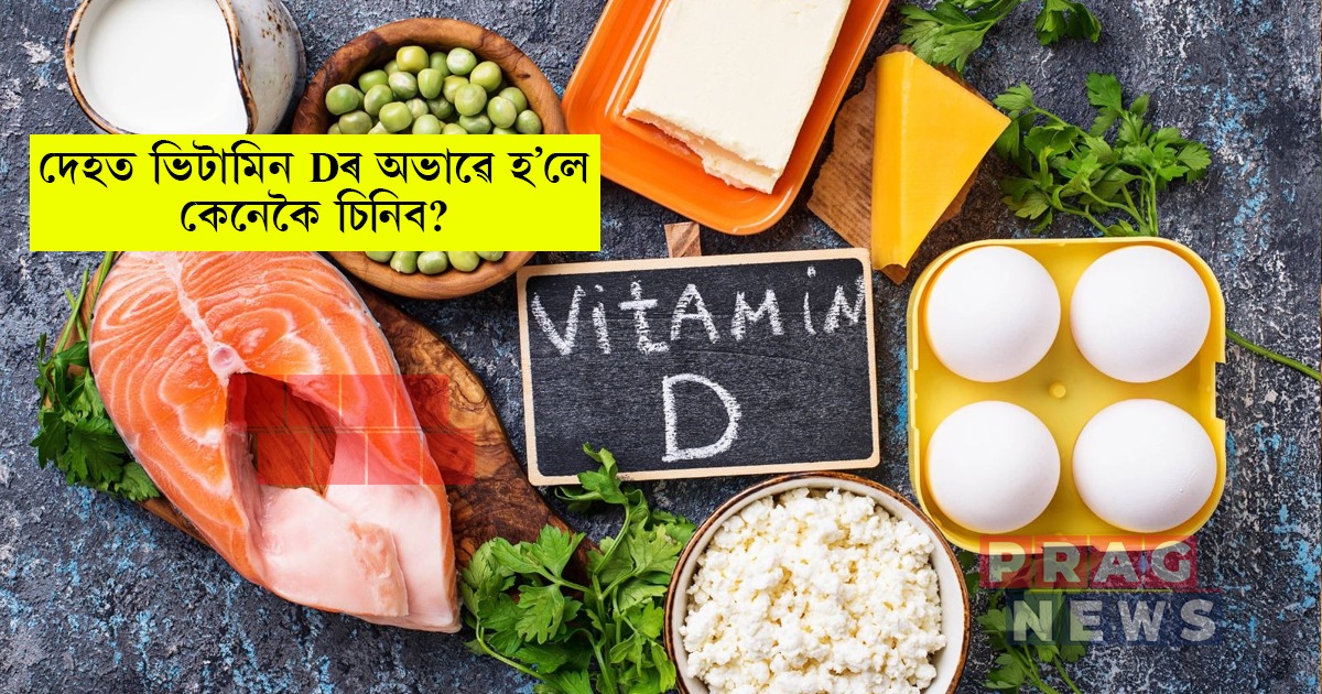 দেহত ভিটামিন ডি-ৰ অভাৱ হ’লে কি কি লক্ষণে দেখা দিয়ে? কি খালে লাভ কৰিব সুফল?
