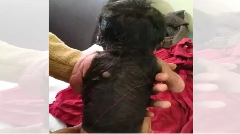 Uttar Pradesh: Baby born with 60 percent body covered in hair in Hardoi