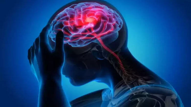 India suffers one stroke death every 4 minutes: AIIMS Neuro Expert