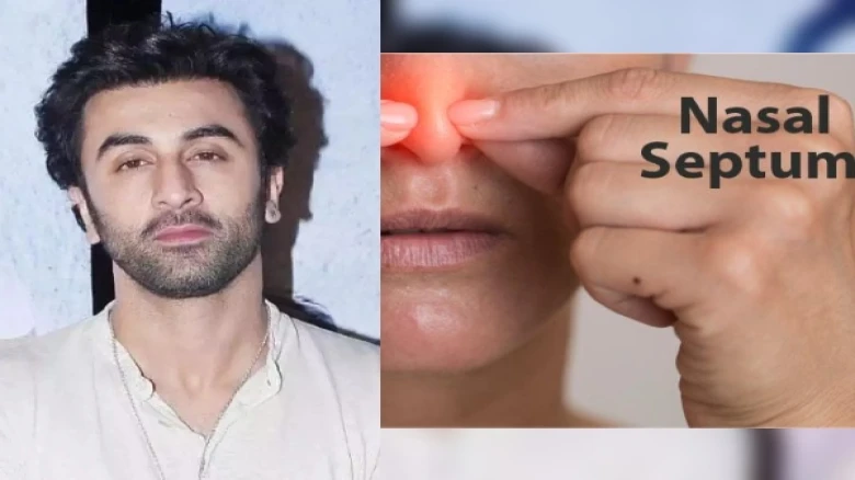 What is Nasal Deviated Septum? A rare condition that makes B town star Ranbir Kapoor eat too fast; Read Here