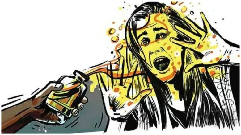 Assam: Spurned lover throws acid on minor girl in Barpeta