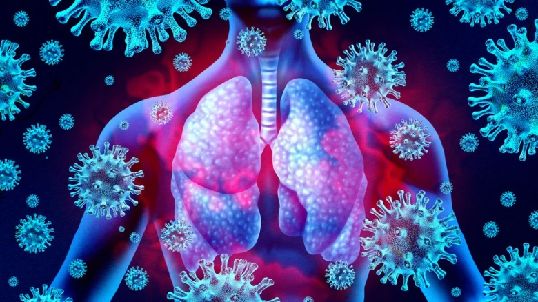 Covid virus can persist in lungs for up to 2 years: Study