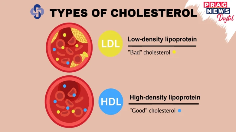 Cholesterol – What Is It And How Does It Affect The Body?