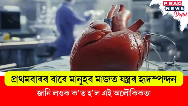 প্ৰথমবাৰৰ বাবে মানুহৰ মাজত যন্ত্ৰৰ হৃদস্পন্দন ; জানি লওক ক’ত হ’ল এই অলৌকিকতা