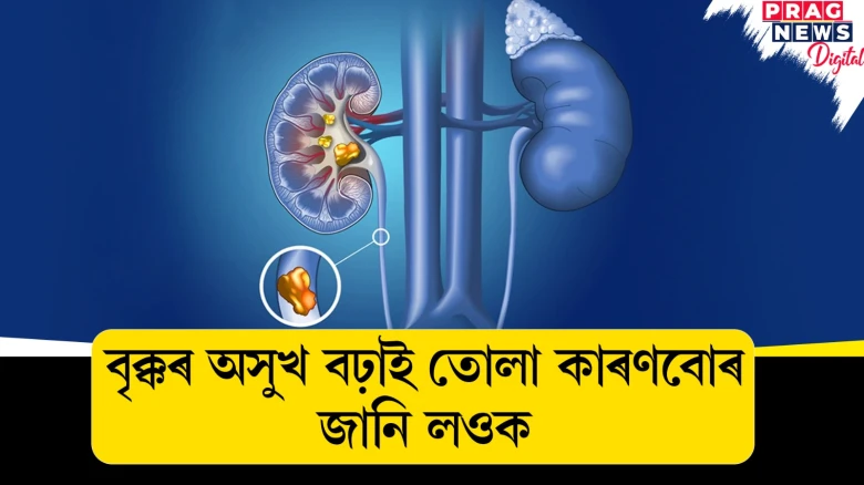 এইবোৰ কথাই বৃক্কৰ অসুখ বঢ়াই তোলে