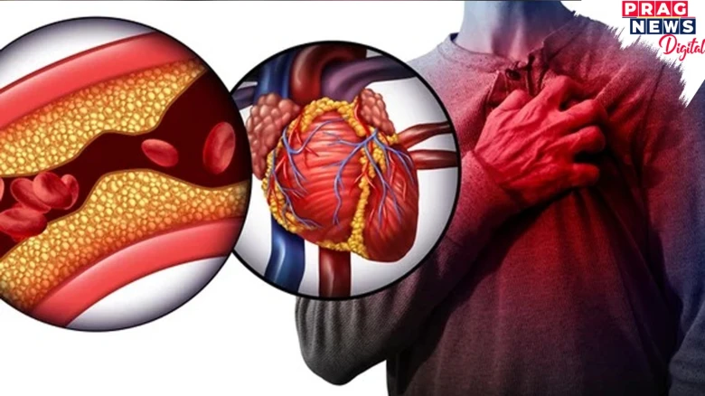 Fatty Muscles Linked to Higher Risk of Heart Disease