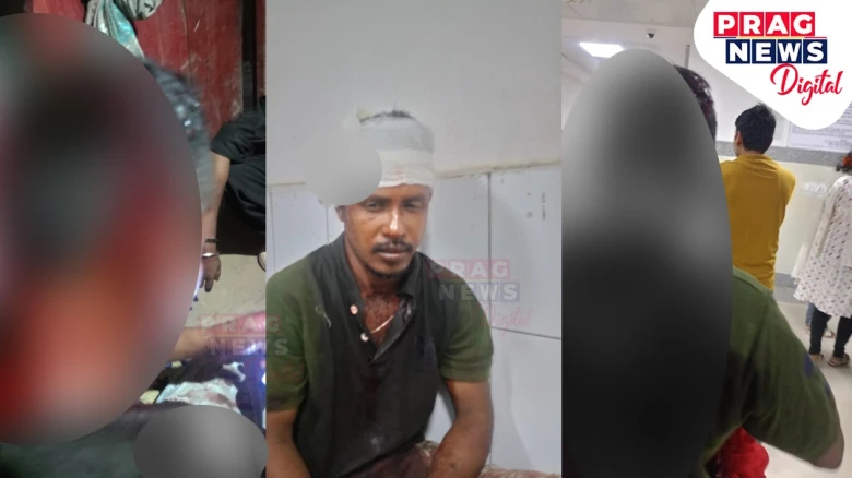 এটা চিগাৰেটৰ বাবেই মহানগৰীত প্ৰচণ্ড মাৰপিটৰ ঘটনা
